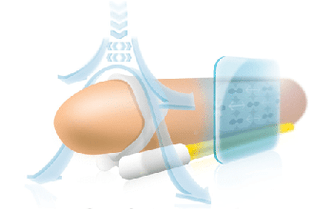 The principle of operation of the extension to stretch the phallus lengthwise