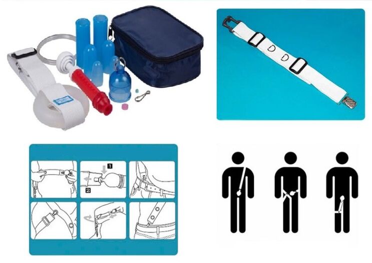 Lengthening and enlarging the penis can be achieved with a stretcher